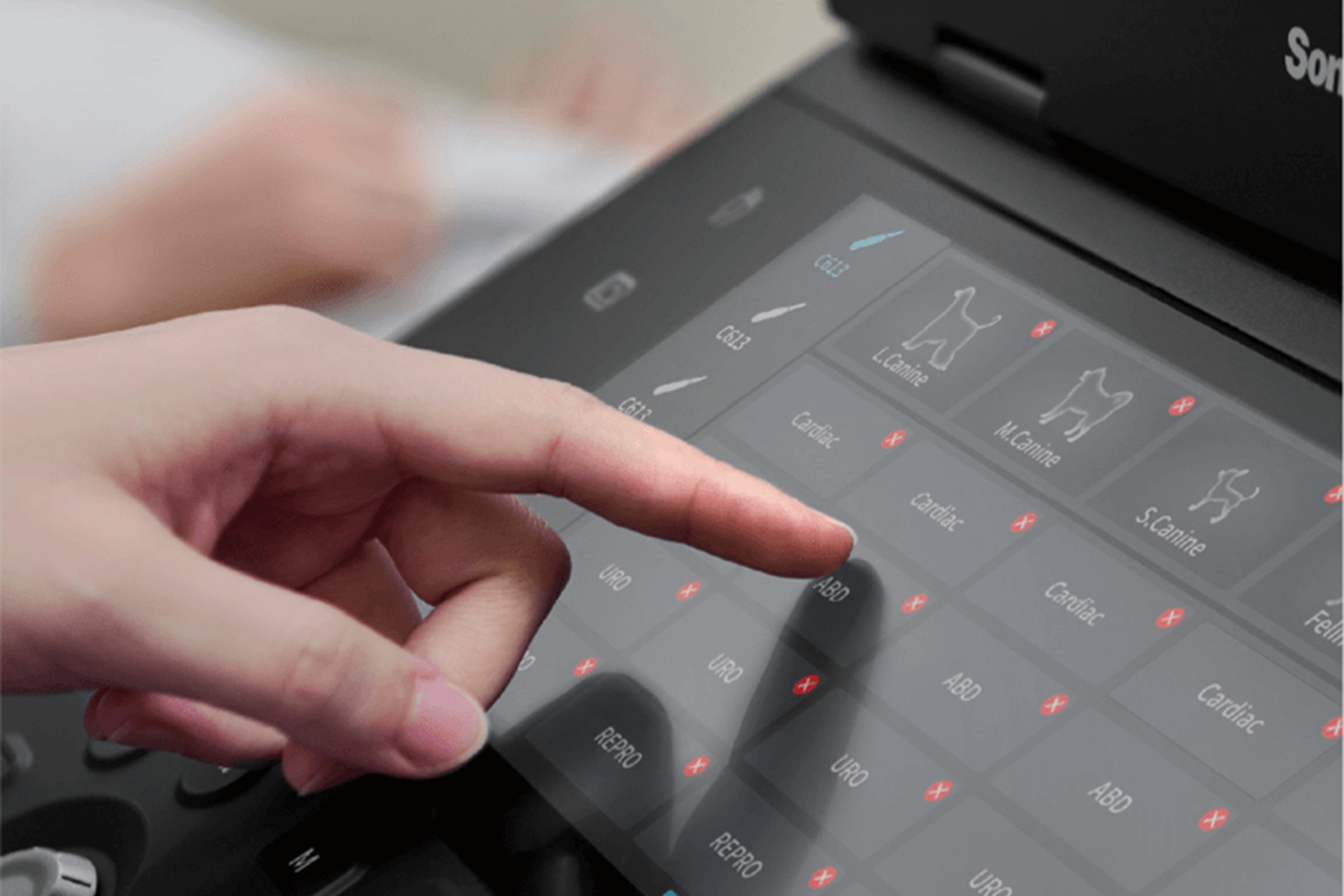 USG przenośne w diagnostyce obrazowej - podstawowe zastosowanie